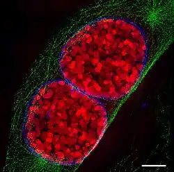 Two mouse cell nuclei in prophase.