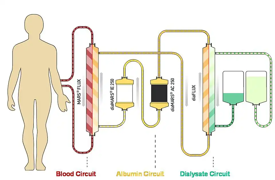 Albumin dialysis circuit