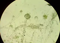 Conidiophores with conidia of the microscopic fungus A. oryzae under light microscope