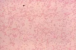 Gram-stained photomicrograph depicting numerous Gram-negative "Brucella canis" bacteria