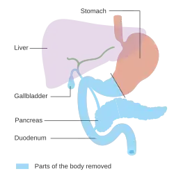 Diagram of the alimentary tract highlighting the gallbladder, pancreas, duodenum and distal stomach