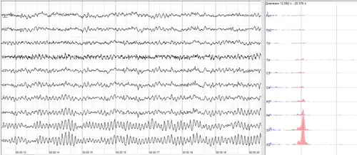Human EEG with prominent resting state activity – alpha-rhythm. Left: EEG traces (horizontal – time in seconds; vertical – amplitudes, scale 100 μV). Right: power spectra of shown signals (vertical lines – 10 and 20 Hz, scale is linear). Alpha-rhythm consists of sinusoidal-like waves with frequencies in 8–12 Hz range (11 Hz in this case) more prominent in posterior sites. Alpha range is red at power spectrum graph.
