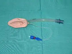 A laryngeal mask.