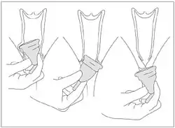 To remove a bell-shaped cup, the seal is broken by running a finger cup the side of the menstrual cup, or pinching the base of the vessel. The cup is then slowly and gently removed, shifting the menstrual cup from side to side.