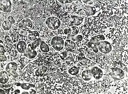 P. polycephalum amoebae growing on lawns of live E. coli. The bacterial cells are approx 1 micron in diameter, amoebae are approx 10 microns in diameter. Bright circular structures inside the amoebae are vacuoles, nuclei are pale grey circles each containing a darker nucleolus. (Phase contrast microscopy.)