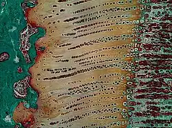 Masson Goldner trichrome stain of growth plate in a rabbit tibia.