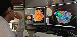 researcher looking at fMRI test