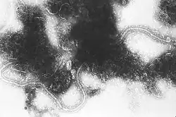 Transmission electron micrograph of Respiratory syncytial virus