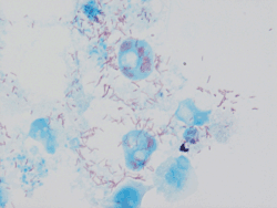 "Rickettsia conorii" observed in Vero cells (red rods; magnification ×1,000)