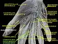 Common palmar digital branches of median nerve