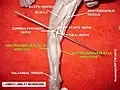 Gastrocnemius muscle (dissection)