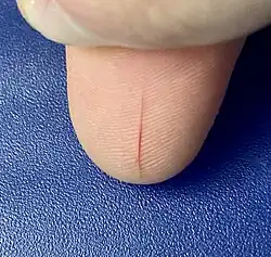 An open paper cut, a few minutes after injury, on the right thumb.